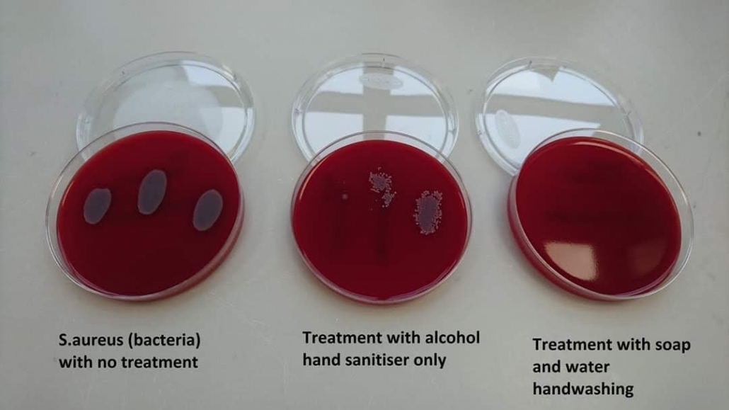 treatment of bacteria in petri dishes