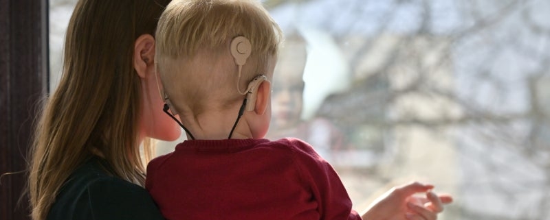What are cochlear implants and how do they work?